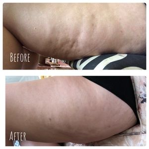 Cellulite firming lotion